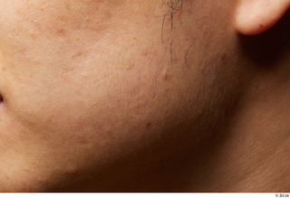HD Face Skin Lan cheek face skin pores skin texture…